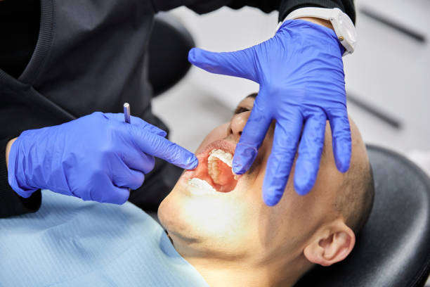 Best Emergency Root Canal Treatment in Scappoose, OR